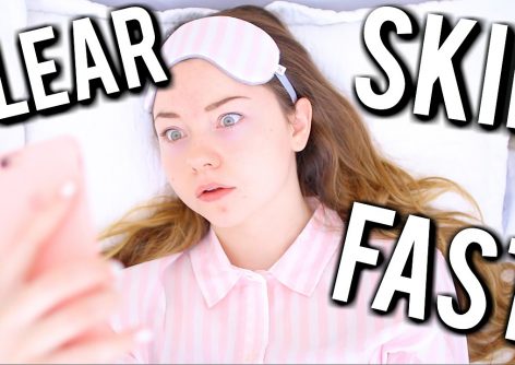 How to get clear skin fast: three trusted home remedies