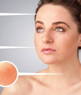 What Type of Acne Do You Have? Types of Acne Explained