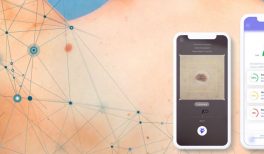 Analysis of Skinive algorithm’s  accuracy for risk assessment of skin conditions, based on machine learning algorithms.